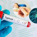 demam tifoid