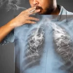 dampak buruk rokok bagi paru-paru