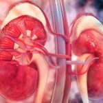 Insufisiensi Ginjal Akut