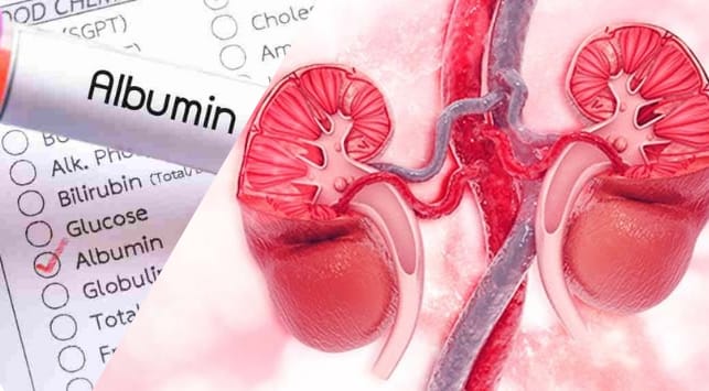 kesehatan ginjal dan albumin